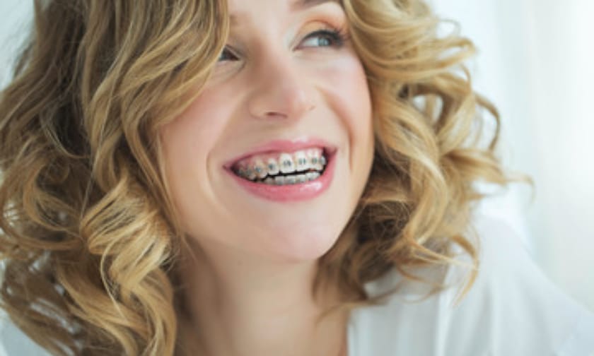 What to Expect Before, During, and After Braces Treatment