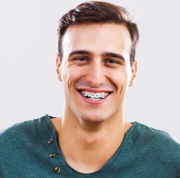 traditional braces San Antonio