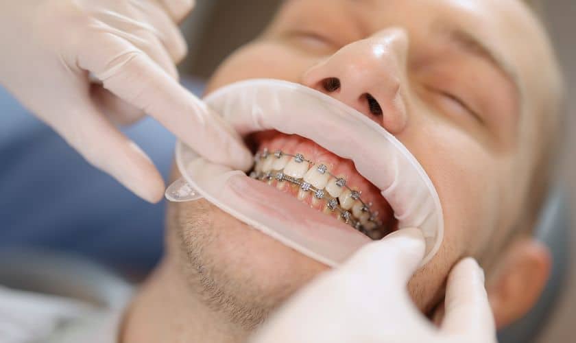 What is The Impact of Orthodontic Treatment?