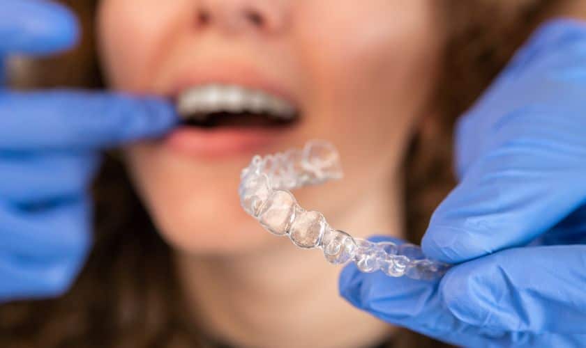 Understanding the Invisalign Process Step by Step
